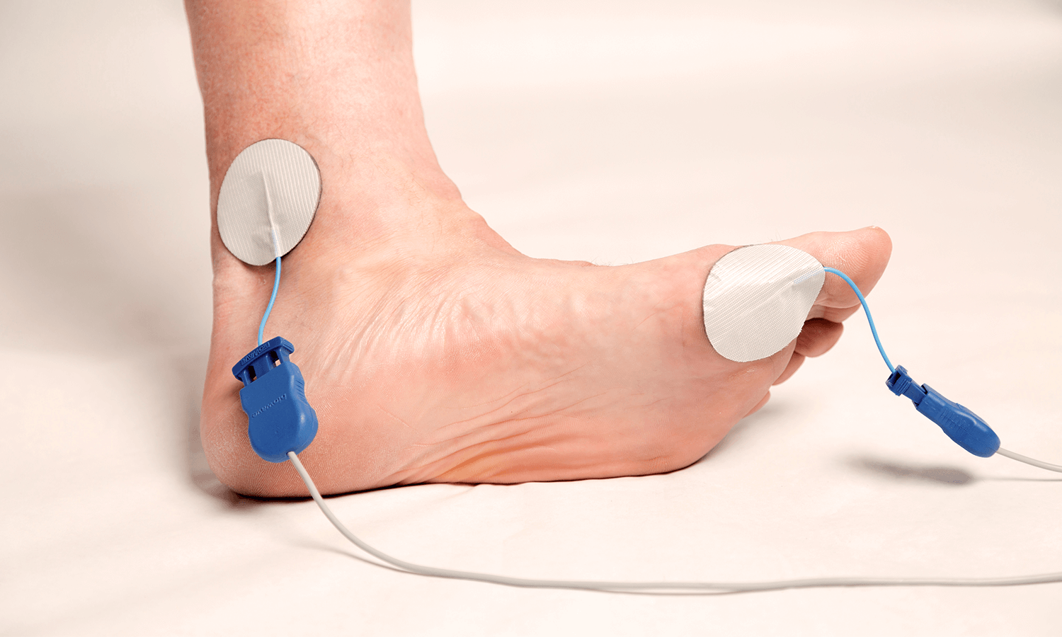 A foot being stimulated by a electrodes to block the transmission of pain